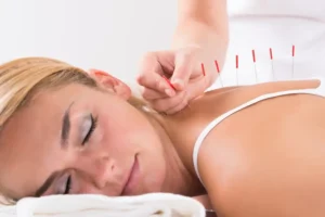 Read more about the article How Much Does Acupuncture Cost?
